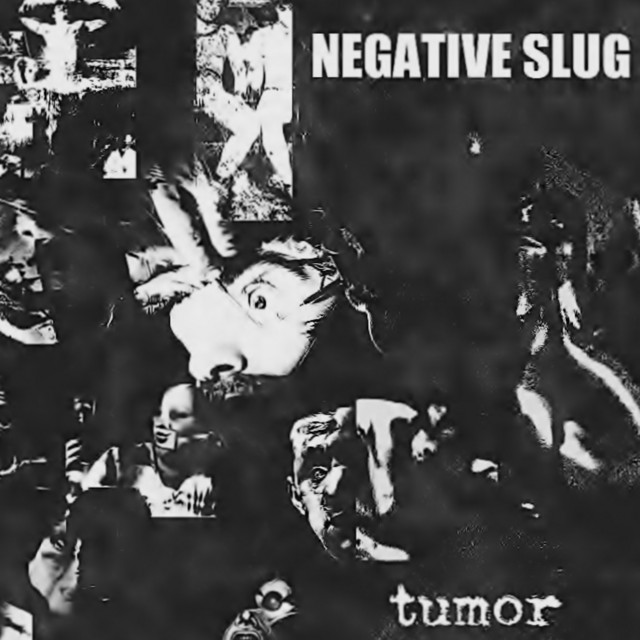 Tumor