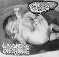 fetal deformity - gangrene discharge split