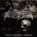 Tuberculosis Reigns