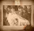 Ulcère EP