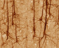 Axons and Dendrites (2014)