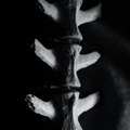 MMXIII
