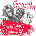 Separated From the Cadaver