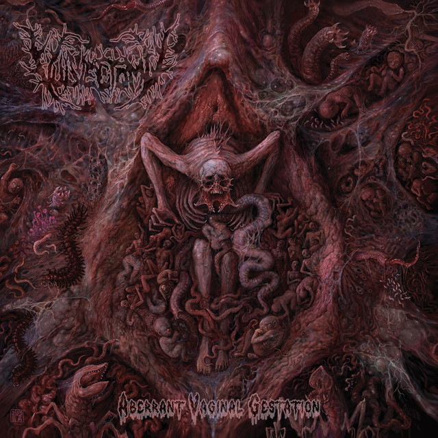 Aberrant Vaginal Gestation