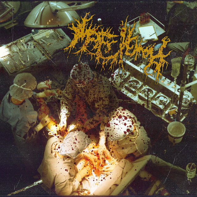 Coprocephalic Abomination / Shitborne Rot
