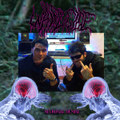 Neuronal Demise
