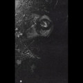 Relapse Into Insanity/Deterioration of Consciousness