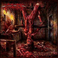 DEBRIDEMENT