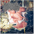 Pneumonia S/T