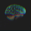 Anhedonia