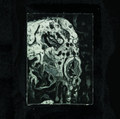 Revelations in Excrement