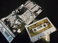 split tape with hyperemesis