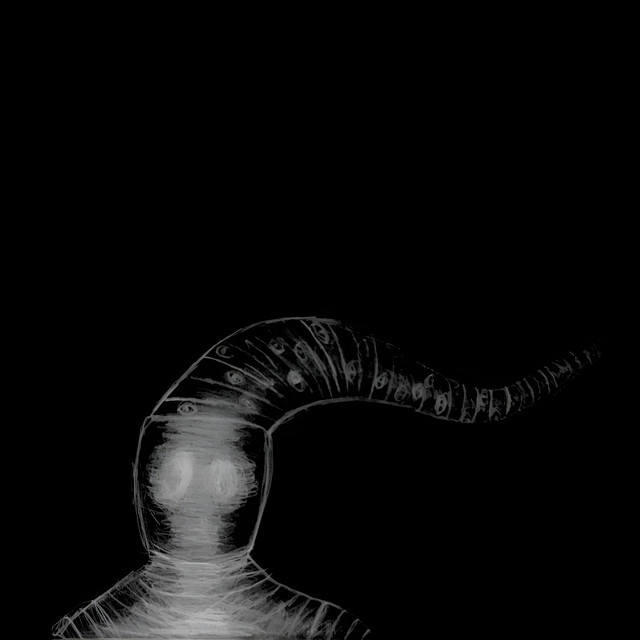 Teratoma