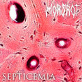 Septicemia