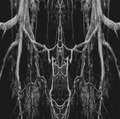 Zatokrev (reissue/remaster)
