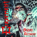 BEYOND RECOVERY (Album)