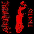 Tinnitus