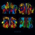 Aèdes