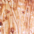 Disgusted Geist/Medicine Noose