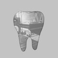 BT01_WISDOM TEETH