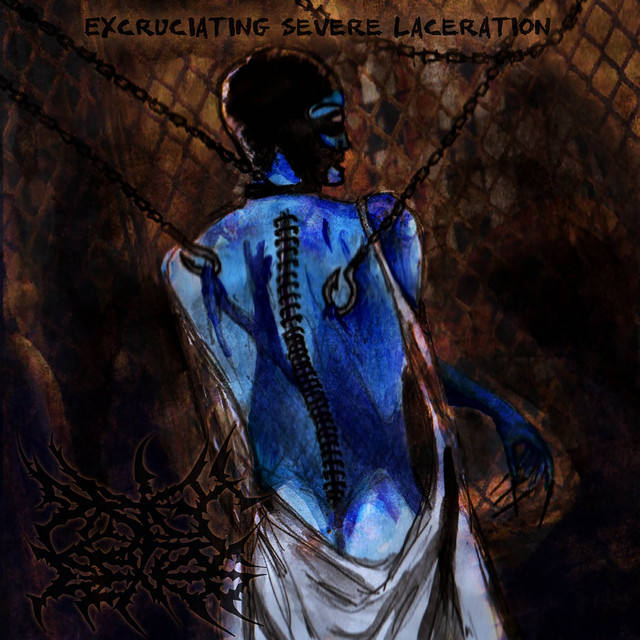 Excruciating Severe Laceration