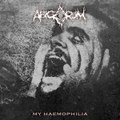 My Haemophilia