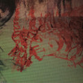 Blood Loss