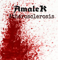Atherosclerosis