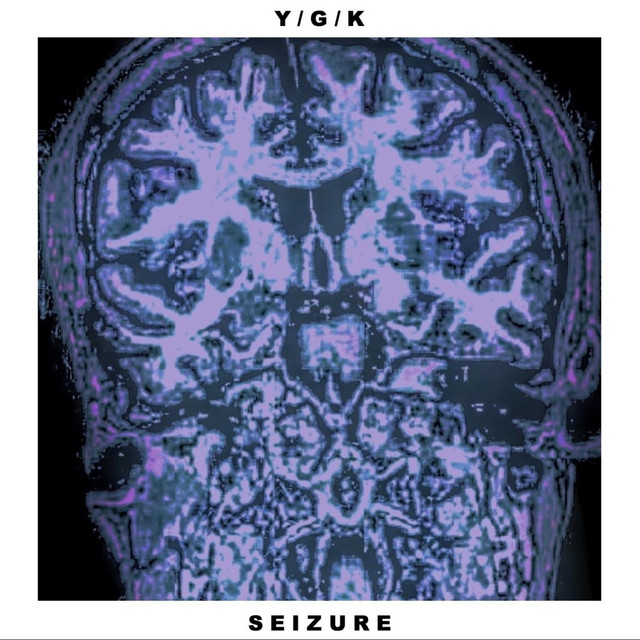 Seizure